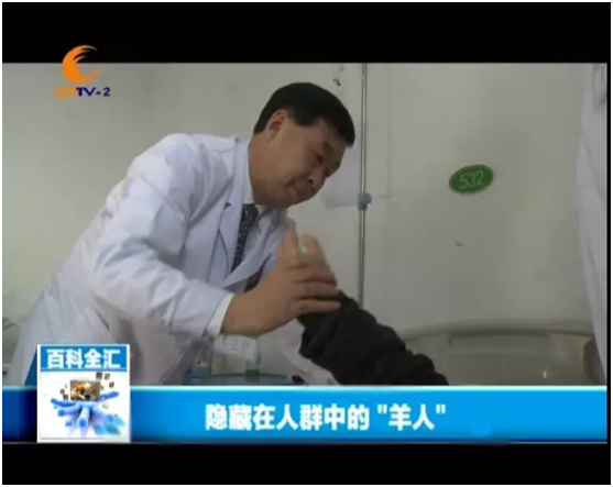 成都资讯频道报道:隐藏在人群中的“羊人” 成都资讯频道报道:隐藏在人群中的“羊人”